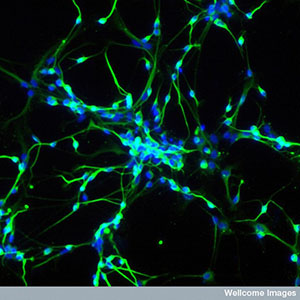 Las células madre se pueden usar para cultivar neuronas en el laboratorio. Estas neuronas son herramientas realmente poderosas para estudiar enfermedades como la EH.  