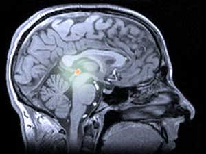 La glándula pineal, ubicada en lo profundo del cerebro, es la principal fuente de la hormona melatonina en los humanos. 